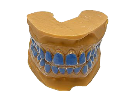 Dentures and partials placeholder